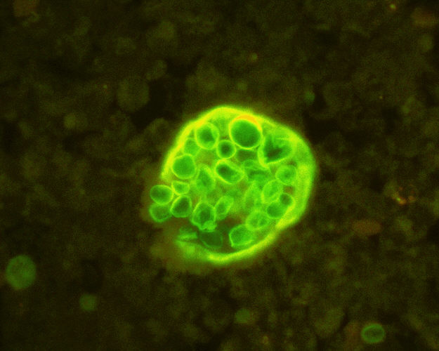 File:Spherule of Coccidioides immitis with endospores.jpg