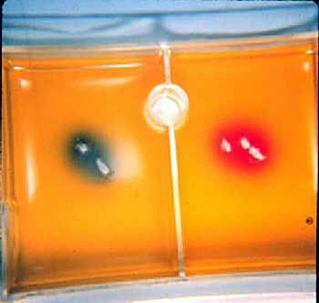 Specialized agar plate, called Dermatophyte Test Medium is used to culture and identify ringworm organisms