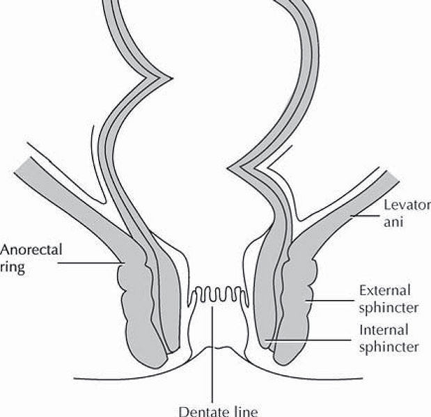 Fissure anal Anal Fissure
