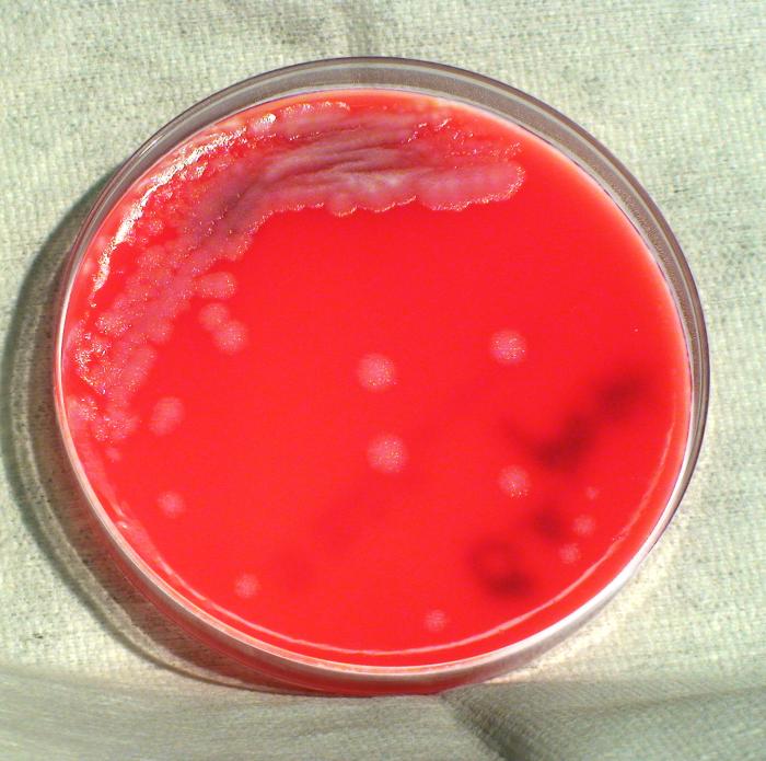 File:Bacillus anthracis19.jpeg
