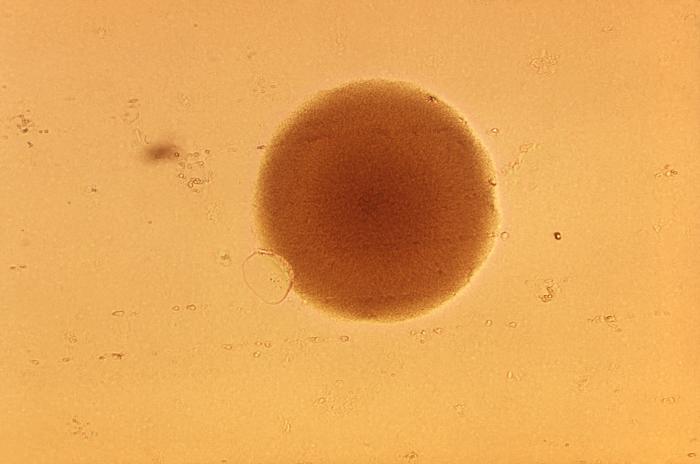 This photograph depicts a single Gardnerella vaginalis, formerly Haemophilus vaginalis, or Corynebacterium vaginalis, bacterial colony.