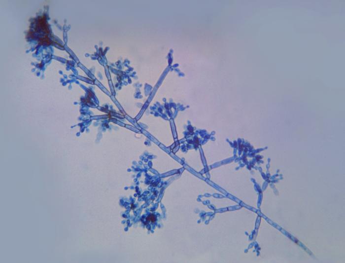 Photomicrograph of the dematiaceous, or dark colored fungi Fonsecaea pedrosoi. From Public Health Image Library (PHIL). [3]