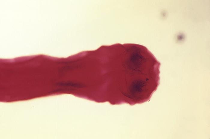 Photomicrograph depicted the “scolex”, or head region of the cestode, Taenia saginata tapeworm. From Public Health Image Library (PHIL). [2]