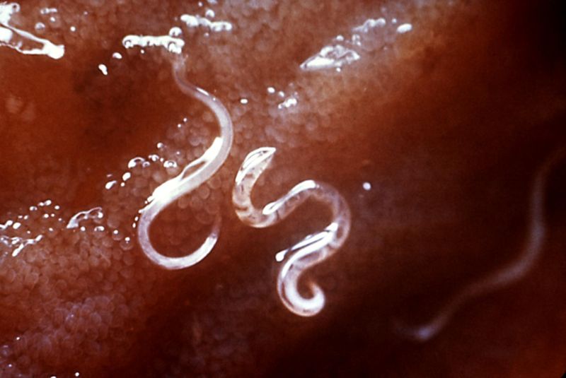 Hookworms attached to the intestinal mucosa