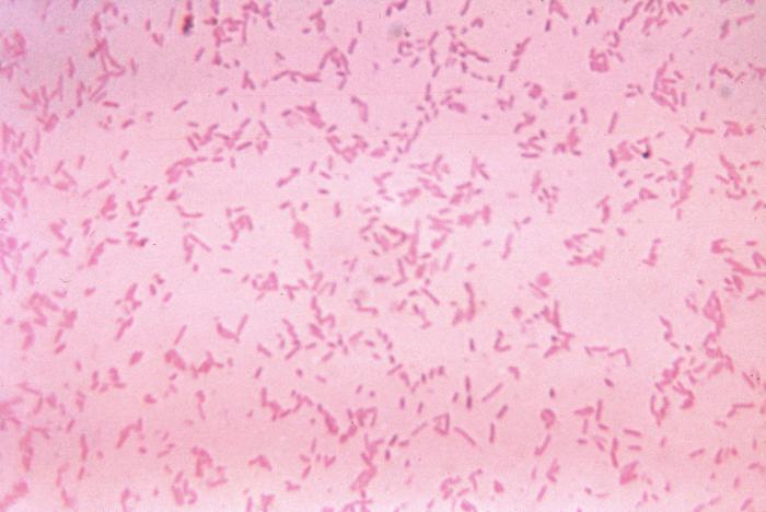This photomicrograph shows Fusobacterium novum after being cultured in a thioglycollate medium for 48 hours. From Public Health Image Library (PHIL). [8]