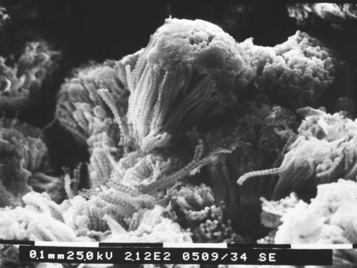 This scanning electron micrograph (SEM) depicts numbers of round asexual Aspergillus sp. fungal fruiting bodies situated amongst a patch of the organism’s septate hyphae. Numbers of chains of conidiospores are visible in this view. From Public Health Image Library (PHIL). [1]