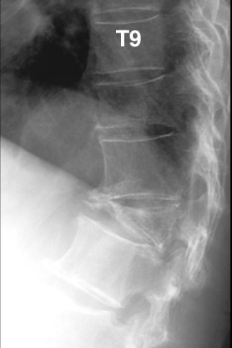 Initial radiograph at time of trauma