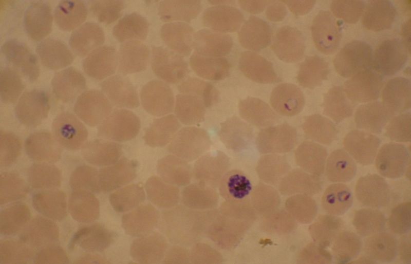 Blood smear from a P. falciparum culture (K1 strain). Several red blood cells have ring stages inside them. Close to the center there is a schizont and on the left a trophozoite.
