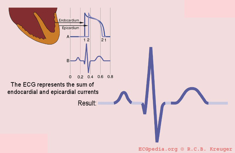 The QRS complex is formed by the sum of the electric avtivity of the inner (endocardial) and the outer (epicardial) cardiomyocytes