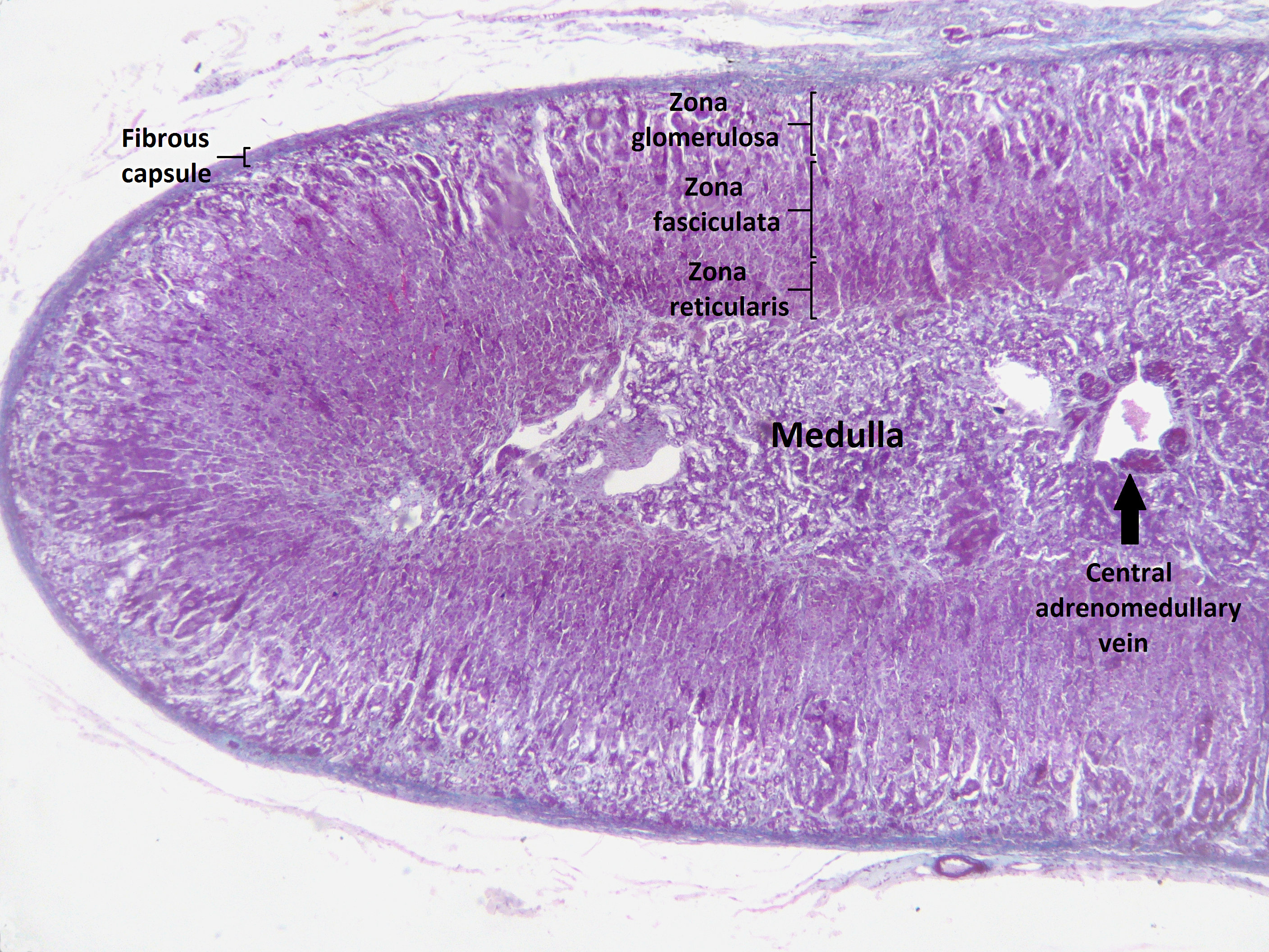 File:Adrenal cortex labelled.jpg