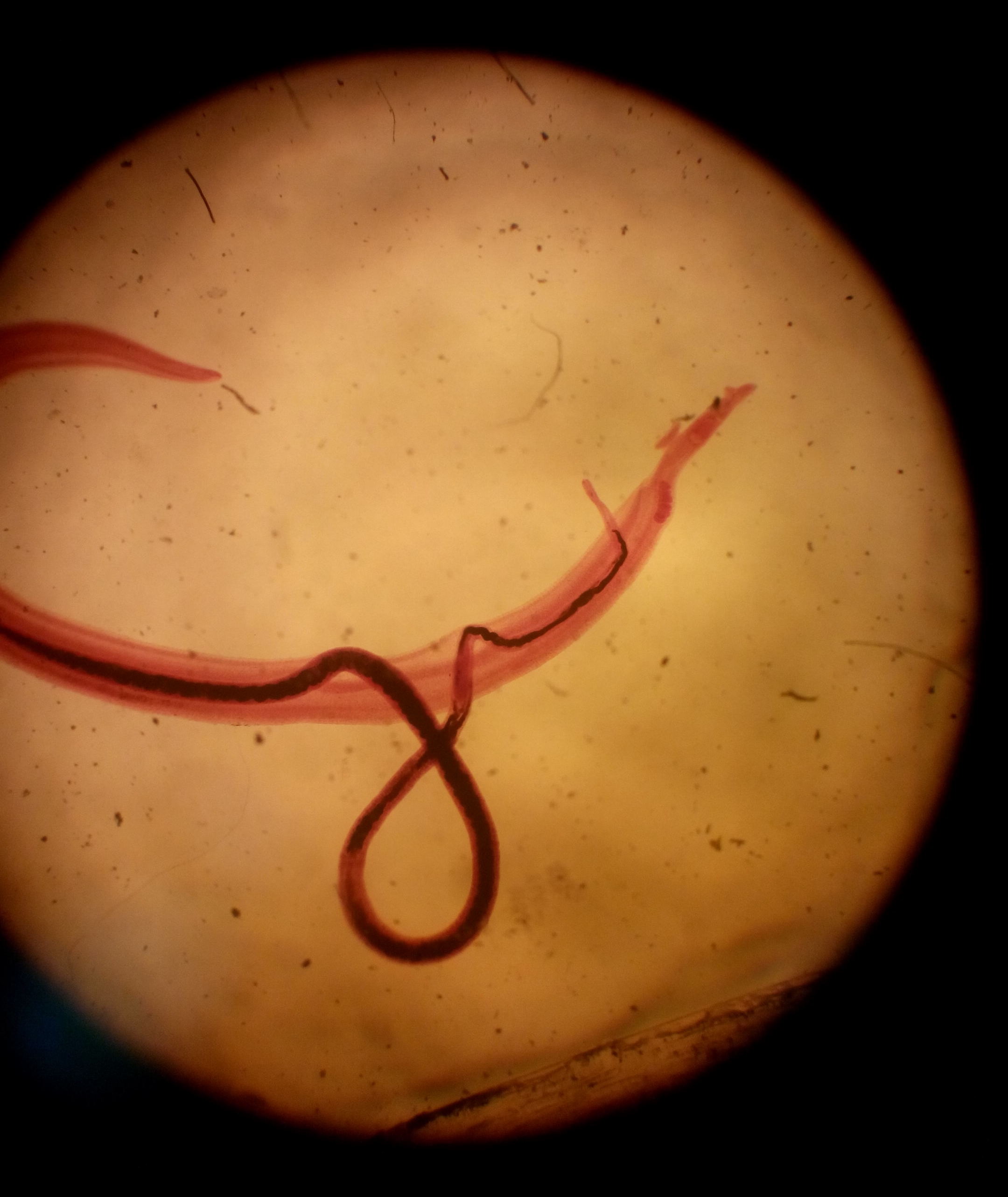 File:Couple of Schistosoma mansoni.jpg