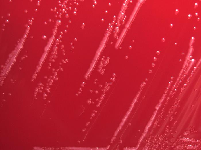 Low-power magnification of 10X of a digital Keyence scope , this photograph depicts the colonial growth displayed by Gram-negative Yersinia pestis bacteria, which were cultured on a sheep blood agar (SBA) medium, for a 24 hour time period, at a temperature of 37°C. Adapted from Public Health Image Library (PHIL), Centers for Disease Control and Prevention.[6]