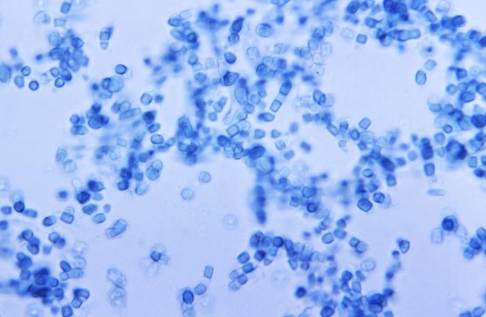 Photomicrograph reveals presence of numerous thick-walled Coccidioides immitis arthroconidia and arthrospores (500x mag). From Public Health Image Library (PHIL). [5]