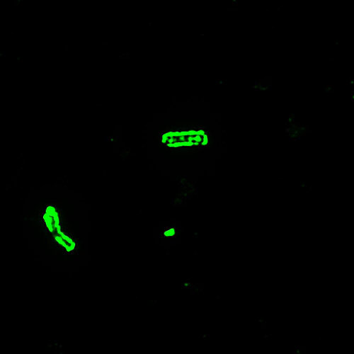 "B. anthracis Direct Fluorescent Antibody (DFA) capsule stain.”Adapted from Public Health Image Library (PHIL), Centers for Disease Control and Prevention.[20]