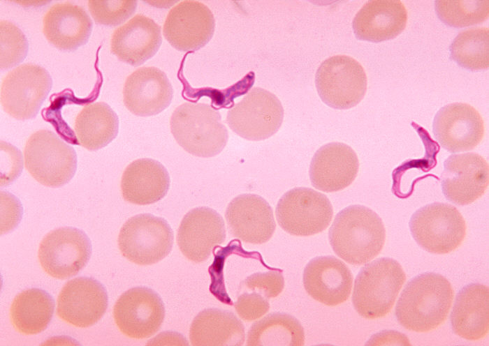 African trypanosomiasis. Adapted from Public Health Image Library (PHIL). [2]