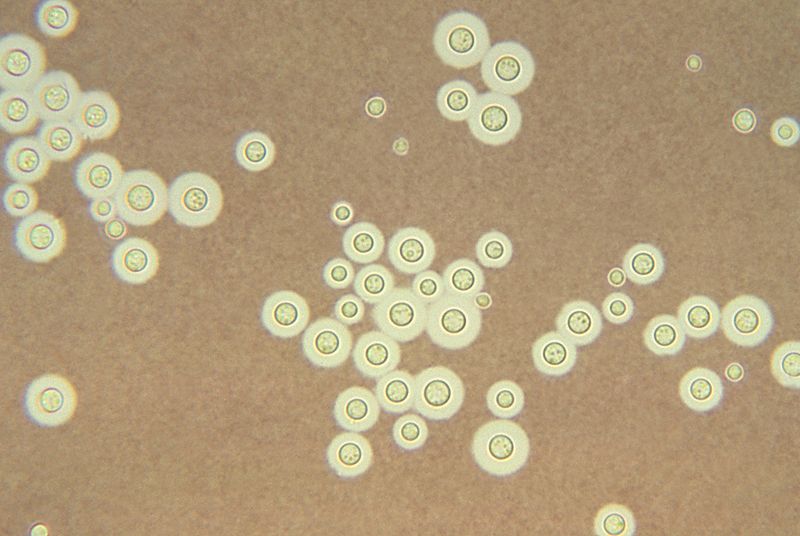 Cryptococcus: clear halo visualized by the india ink stain - Source: https://www.cdc.gov/