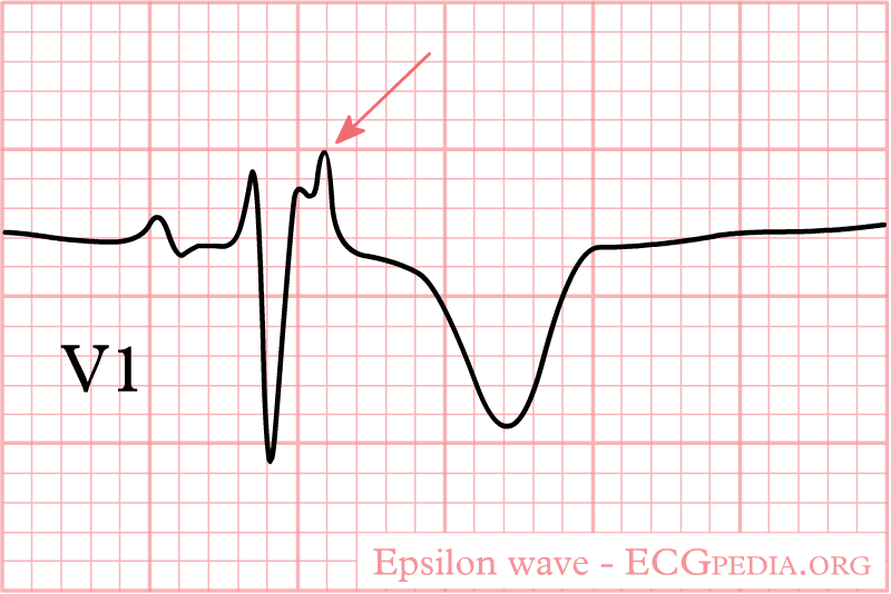 File:Epsilon wave.png