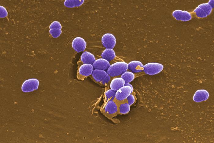 SEM depicts Gram-positive Enterococcus faecalis sp. bacteria. From Public Health Image Library (PHIL). [10]