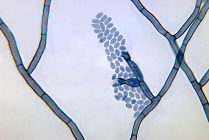 Photomicrograph depicts a conidia-laden conidiophore of a Phialophora verrucosa fungal organism from a slide culture. From Public Health Image Library (PHIL). [3]