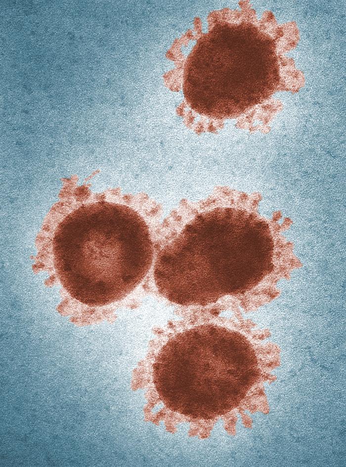 TEM revealed the presence of a number of infectious bronchitis virus (IBV) virions. From Public Health Image Library (PHIL). [3]