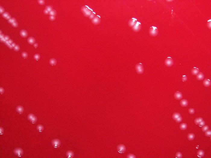 Gram-negative Yersinia pseudotuberculosis bacteria, cultured on SBA 24hrs (10x mag). From Public Health Image Library (PHIL). [3]