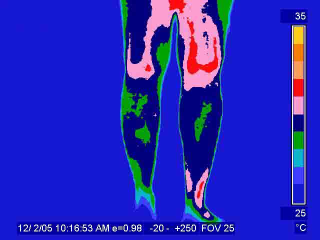 File:Infrared legs.jpg