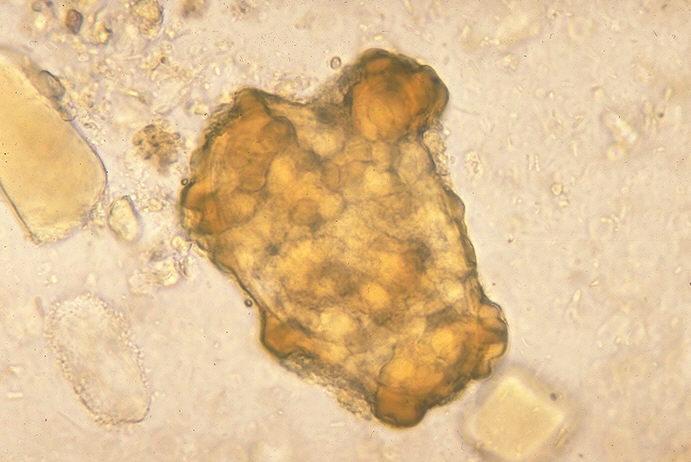 Infertile egg of Ascaris lumbricoides. From Public Health Image Library (PHIL). [2]