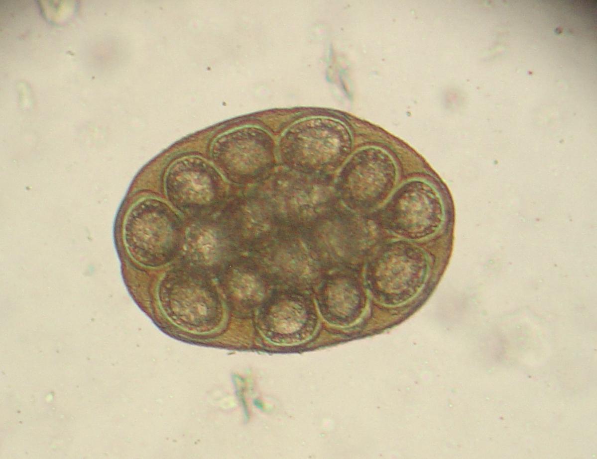 File:Dipylidium caninum ovum 1.JPG