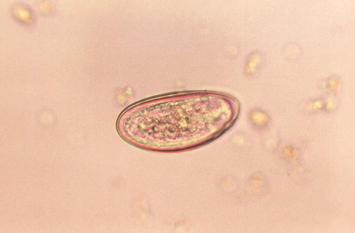 Enterobius vermicularis eosinophilia, Parazita tabletták a legjobbak