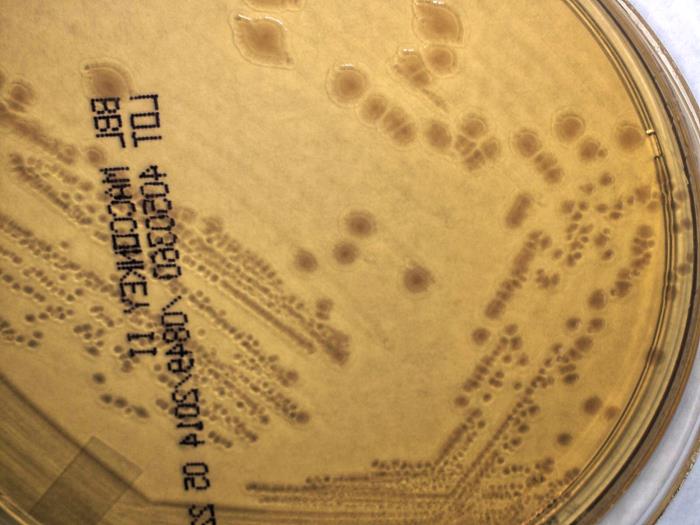 Gram-negative Yersinia pseudotuberculosis bacteria, cultured on a MacConkey agar (MAC) medium 72hrs (5x mag). From Public Health Image Library (PHIL). [3]