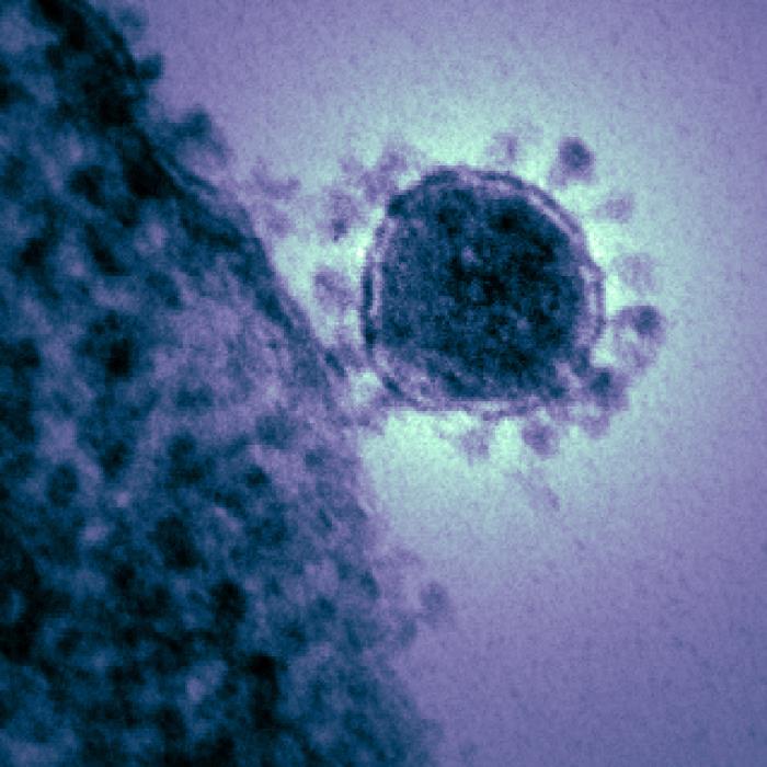 TEM reveals ultrastructural details exhibited by a single, spherical-shaped Middle East Respiratory Syndrome Coronavirus (MERS-CoV) virion. From Public Health Image Library (PHIL). [15]