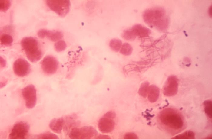 File:Fusobacterium09.jpeg