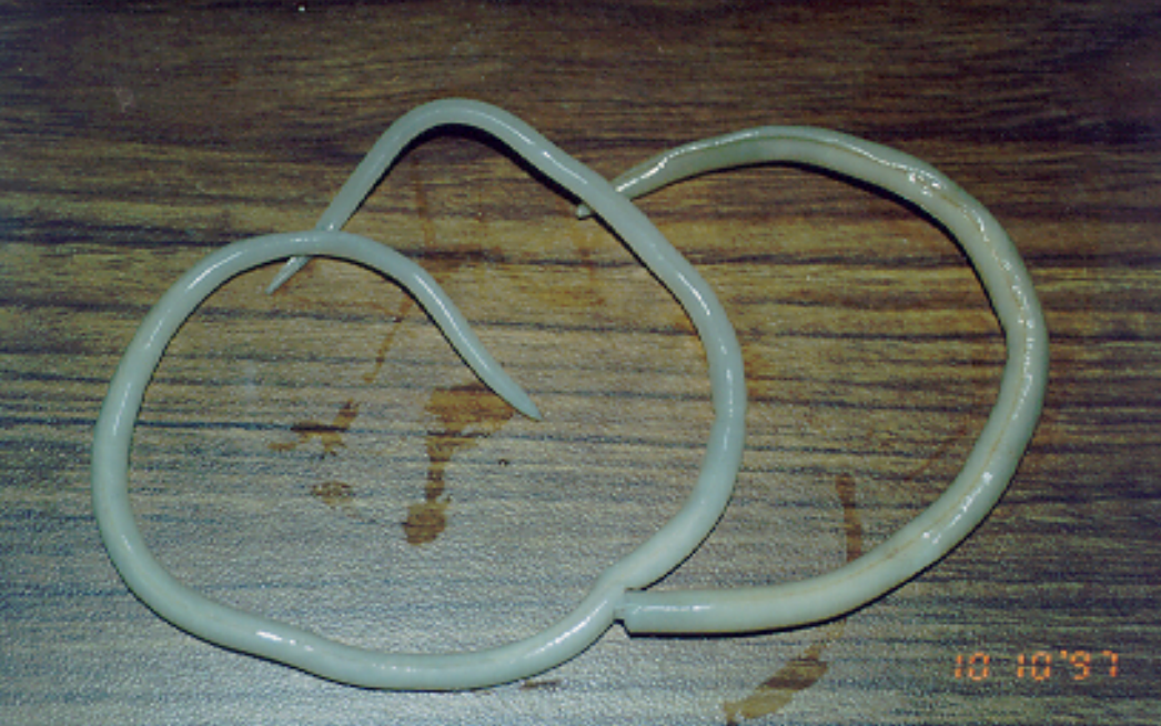 File:Ascaris lumbricoides adult worms.png
