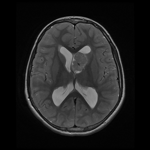 File:SEGA MRI.jpg