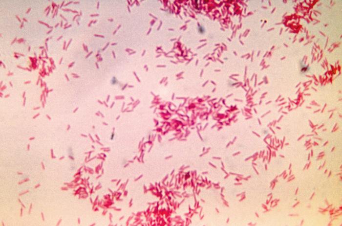 Fusobacterium russii cultured in a thioglycollate medium for 48 hours. From Public Health Image Library (PHIL). [10]