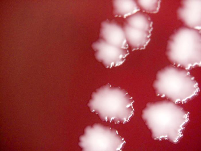 Yersinia pestis bacteria cultured on a sheep blood agar (SBA) medium, for a 120hrs (20x mag). Adapted from Public Health Image Library (PHIL), Centers for Disease Control and Prevention.[6]
