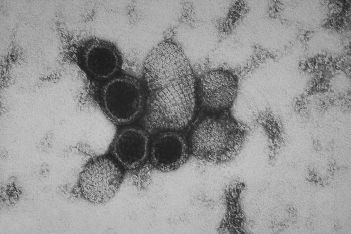 This transmission electron micrograph (TEM) revealed the ultrastructural appearance of a number of virus particles, or “virions”, of the hantavirus known also, as the Sin Nombre virus (SNV). From Public Health Image Library (PHIL). [1]