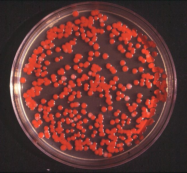 Serratia marcescens appears as bloody red spots on culture medium. From WikiMedia.org. [5]