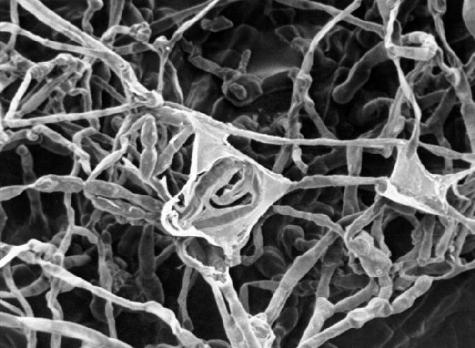 SEM reveals some of the ultrastructural morphology this pigmented, or dematiaceous mould, Xylohypha nigrescens, know to cause phaeohyphomycosis, chromoblastomycosis, and mycetoma. From Public Health Image Library (PHIL). [1]