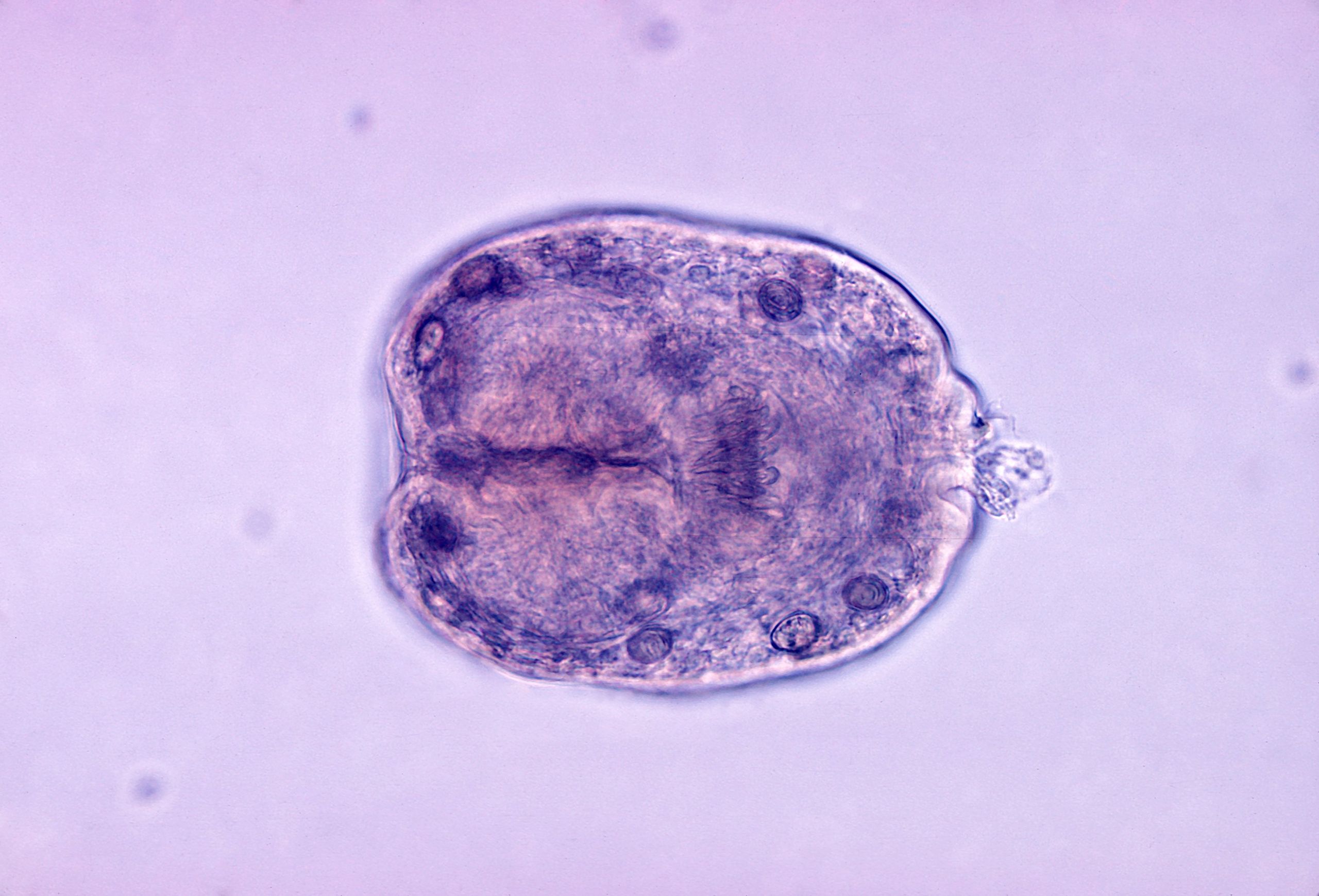 File:Echinococcus granulosus scolex.jpg