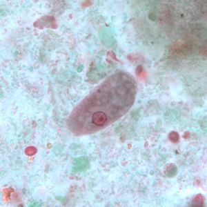 Trophozoites of E. coli stained with trichrome