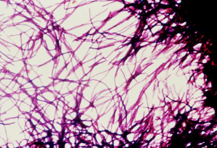 Impression smear photomicrograph of Clostridium difficile bacteria grown on cycloserine mannitol blood agar. From Public Health Image Library (PHIL). [1]
