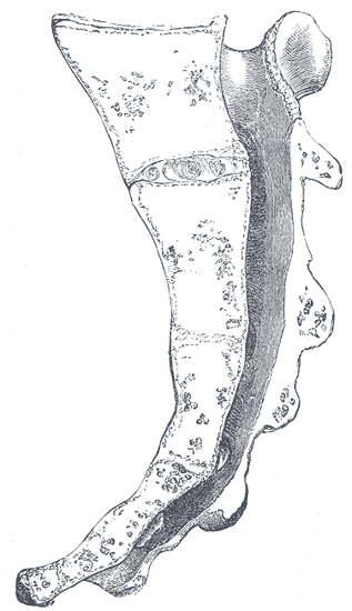 Median sagittal section of the sacrum.