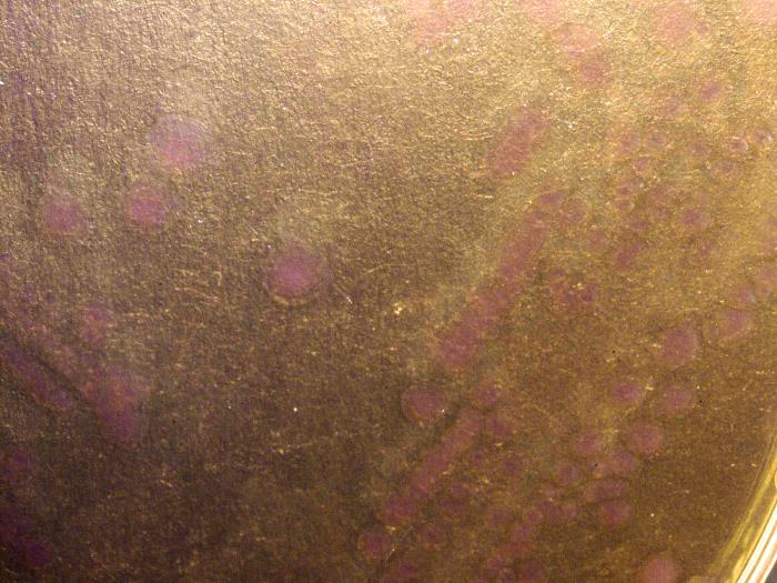 Gram-negative Yersinia pseudotuberculosis bacteria, cultured on a MacConkey agar (MAC) medium 72hrs (10x mag). From Public Health Image Library (PHIL). [3]