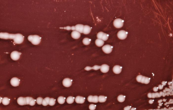 Providencia alcalifaciens bacteria cultured on a blood agar plate (BAP). From Public Health Image Library (PHIL). [4]