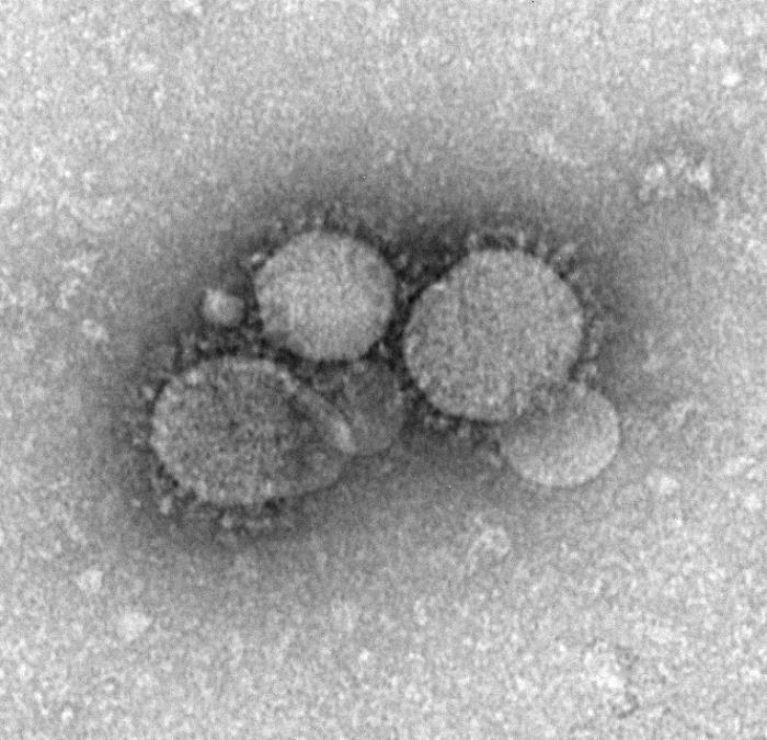 TEM reveals ultrastructural morphology of the Middle East Respiratory Syndrome Coronavirus (MERS-CoV). From Public Health Image Library (PHIL). [32]