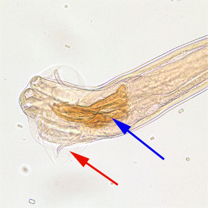 File:Trichostrongylus male posterior 200x.jpg