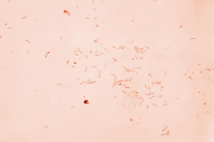 Gram-stained photomicrograph reveals the presence of numerous Gram-negative Plesiomonas shigelloides bacteria. From Public Health Image Library (PHIL). [1]