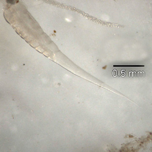File:Evermicularis SC posterior.jpg