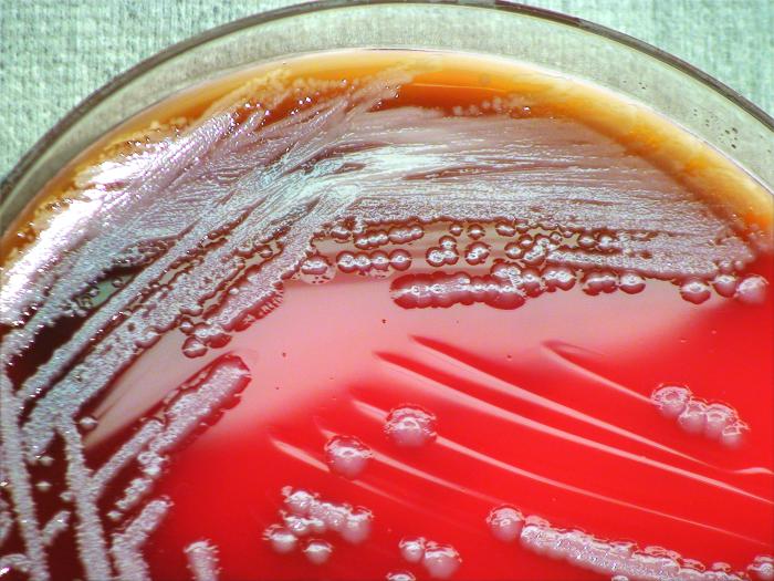 Colonial morphology colonial morphology displayed by Gram-negative Burkholderia thailandensis bacteria, grown on a medium of sheep’s blood agar (SBA). From Public Health Image Library (PHIL). [3]